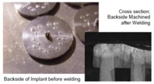 Medical Implant